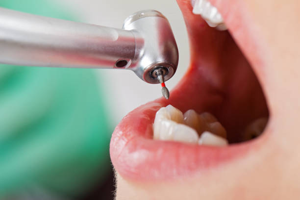 Best Emergency Gum Pain Relief  in Fennville, MI